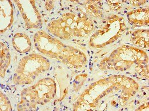 KLRC1 Antibody