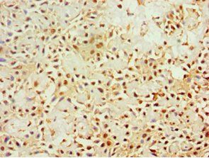 KLRC1 Antibody