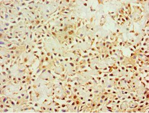 KLRC1 antibody