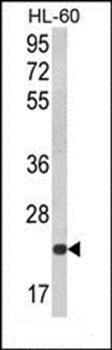 KLRC2 antibody