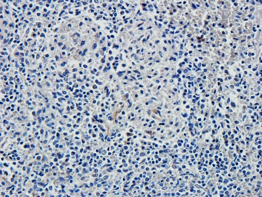 KLRC2 antibody