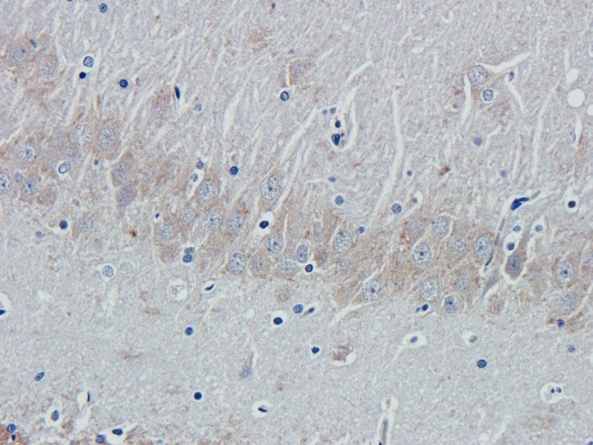 KLRC2 antibody