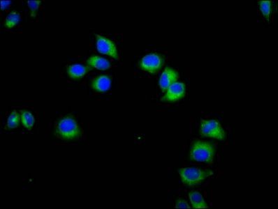 KLRC3 antibody