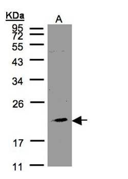 KLRC4 Rabbit Polyclonal Antibody