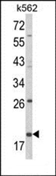 KLRD1 antibody