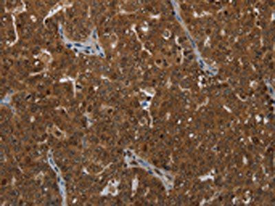 KLRF1 Antibody