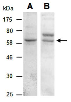 KLRG1 (C) Antibody, Rabbit Polyclonal