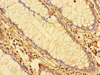 KPNA2 Antibody