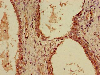 KPNA4 antibody