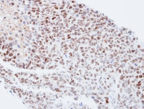 KPNA4 antibody [C3], C-term