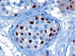 Goat anti-KPNA4 / IPOA3 Antibody