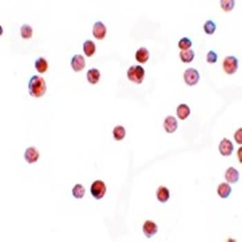 KPNA4 Antibody