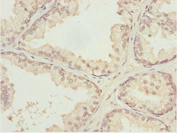 KPNA6 Antibody