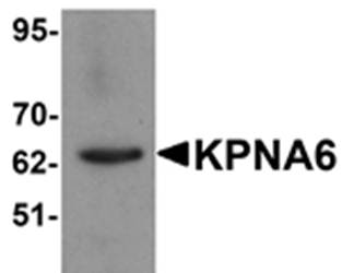 KPNA6 Rabbit Polyclonal Antibody