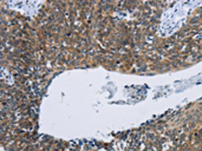 KPNB1 Antibody