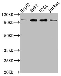 KPNB1 antibody