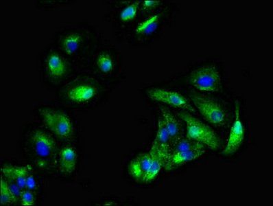 KRAS Antibody