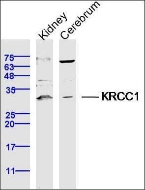 KRCC1 antibody