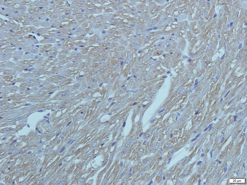 KREM1 antibody