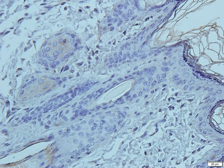KREM1 antibody