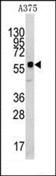 KREMEN1 antibody