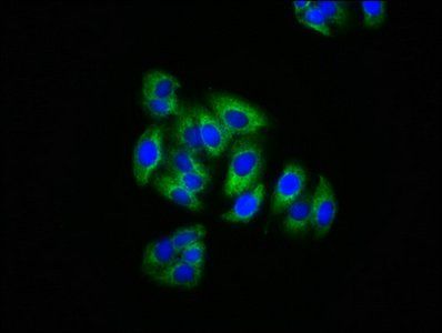 KRIT1 antibody