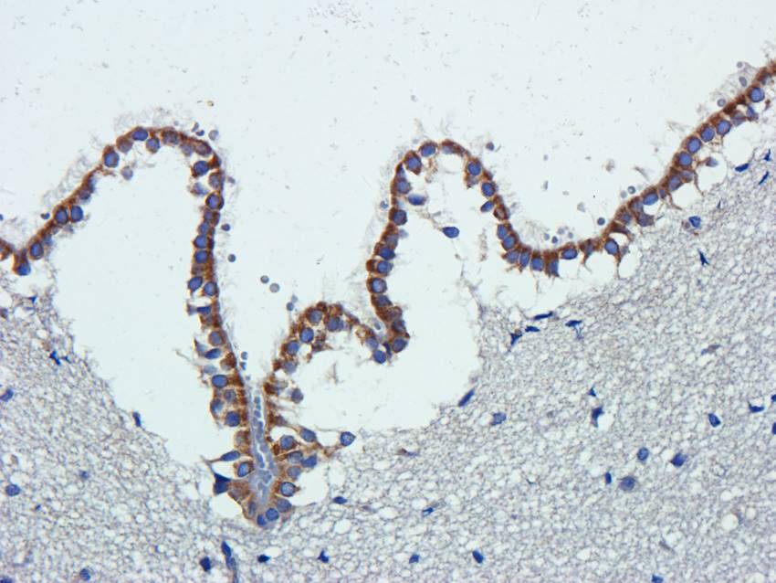 Krox-20 (EGR2) antibody