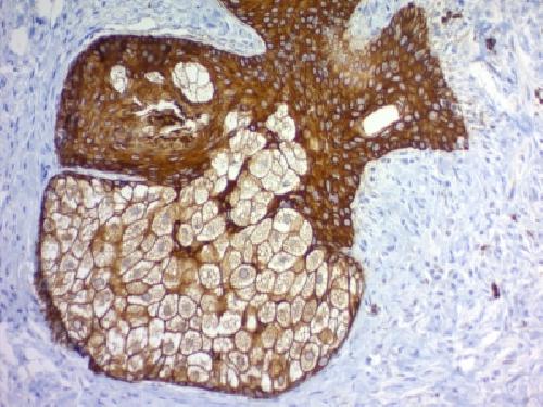Cytokeratin, pan (Epithelial Marker) Antibody