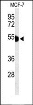 KRT1 antibody