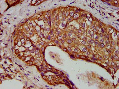 KRT1 Antibody