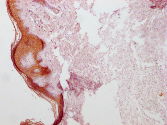 KRT1 Antibody