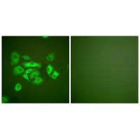 KRT10 Antibody