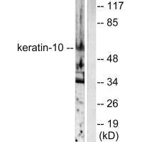 KRT10 antibody
