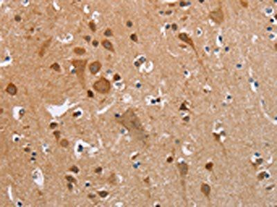 KRT13 Antibody