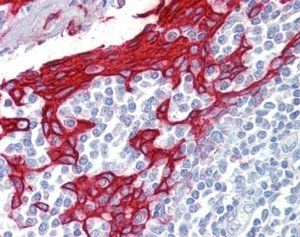 Goat anti-KRT13 Antibody