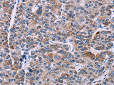 KRT14 Antibody