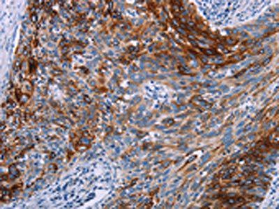 KRT14 Antibody