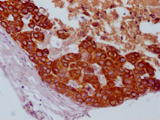 KRT14/KRT16/KRT5/KRT6A/KRT8 Monoclonal Antibody