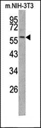 KRT14 antibody