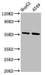 KRT16 antibody