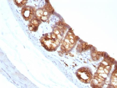 KRT18 Antibody