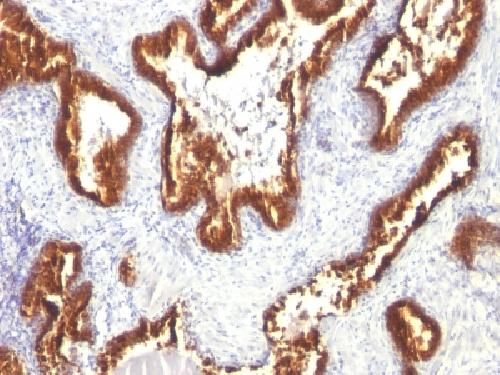 KRT18 Antibody