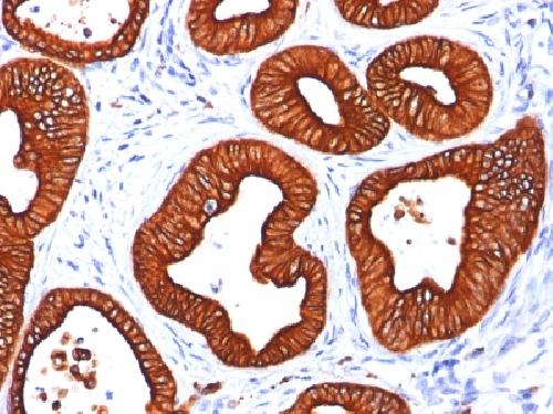 Cytokeratin 18 (KRT18) Antibody