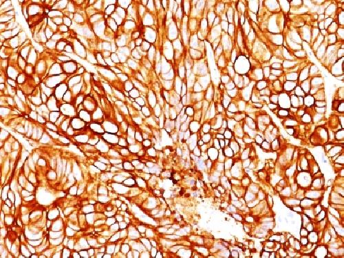 KRT18 Antibody