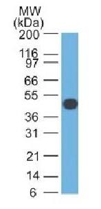 KRT18 Antibody