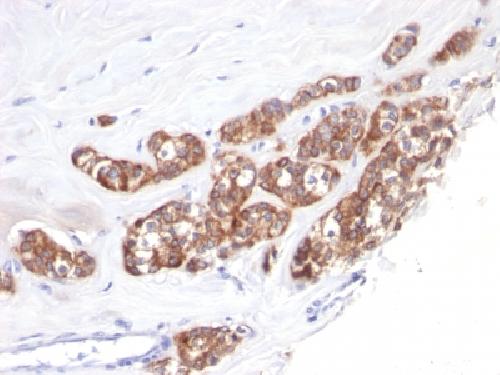 KRT18 Antibody