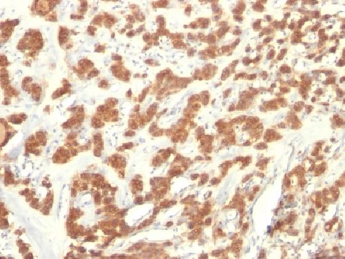 Cytokeratin 18 (KRT18) Antibody