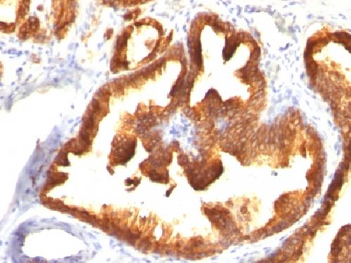KRT18 Antibody