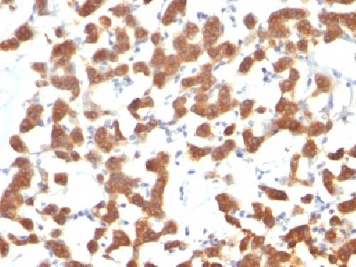 KRT18 Antibody