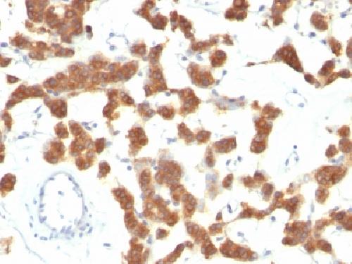 KRT18 Antibody